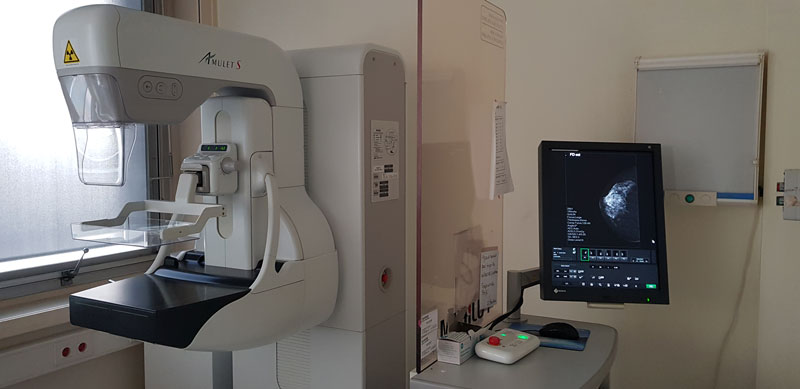 Appareil de radiographie utilisé pour l’examen de dépistage du cancer du sein